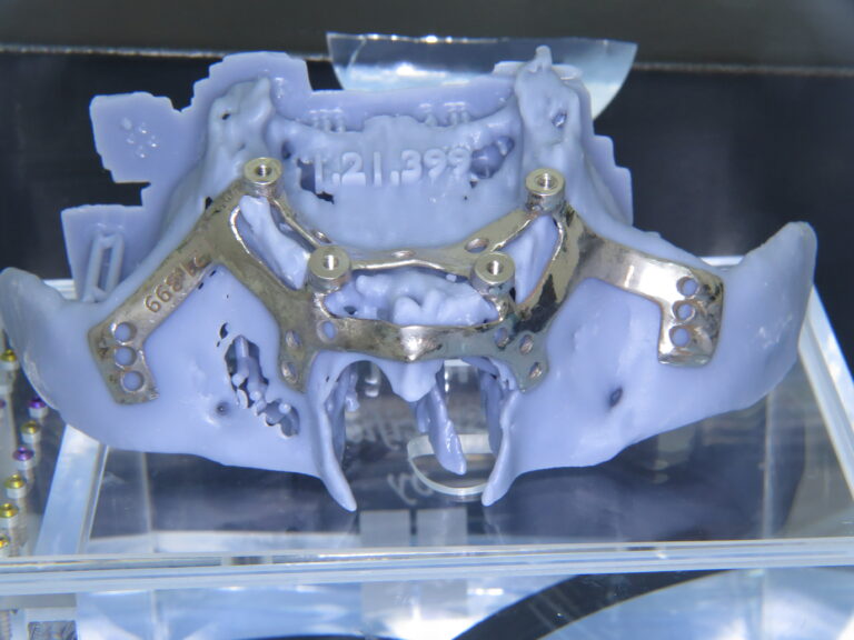 PSI-Titankonstruktion